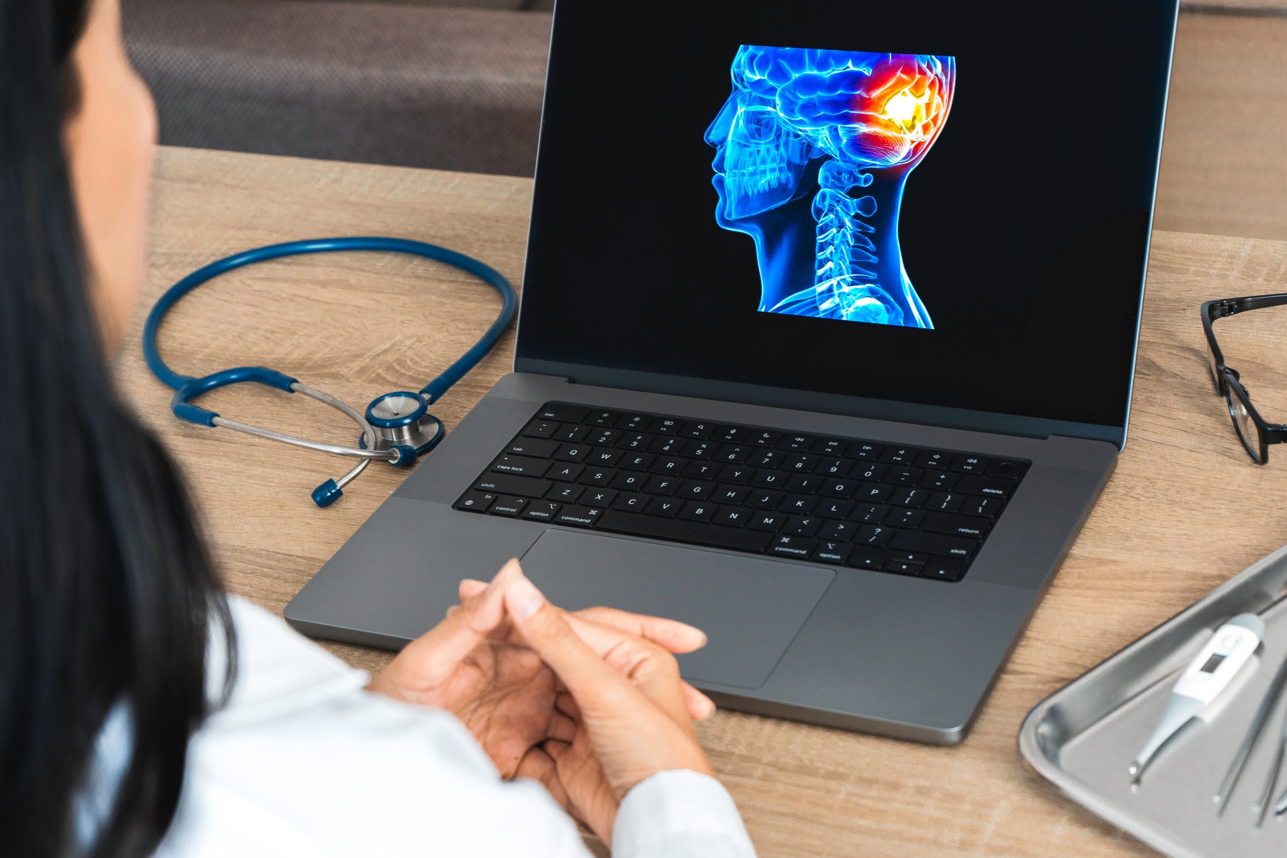 Milton Traumatic Brain Injury Lawyer